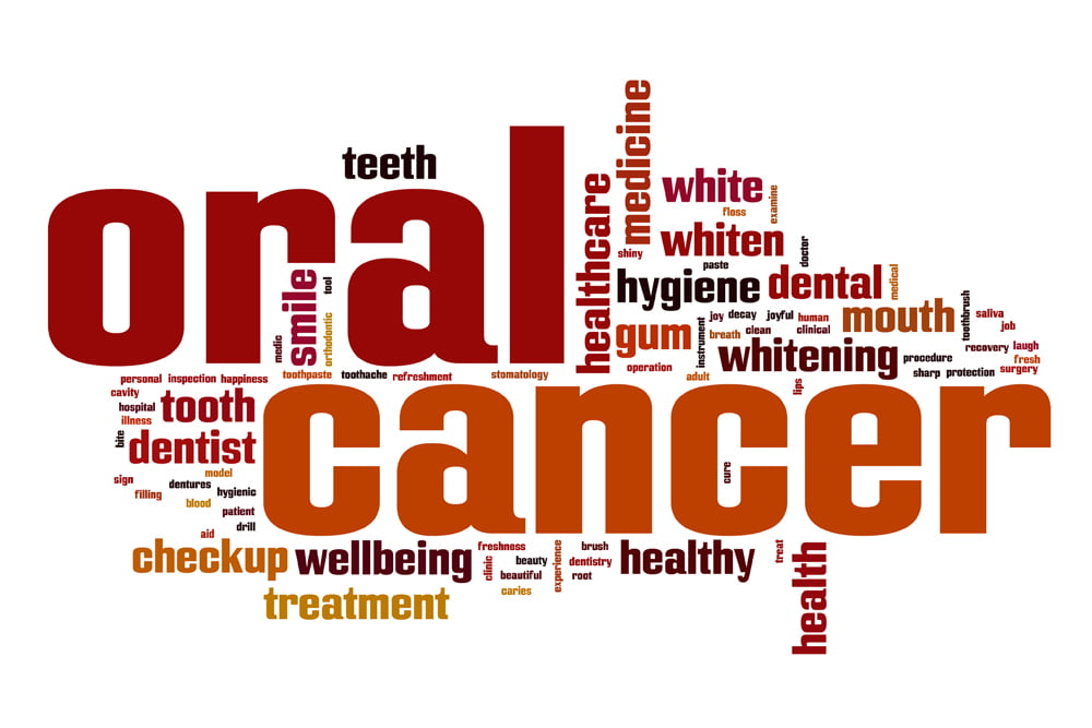 Oral Cancer: Early Detection Improves Treatment 