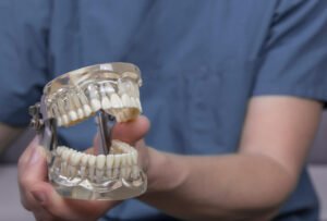 El Dorado Hills dentist holding a complete set of teeth