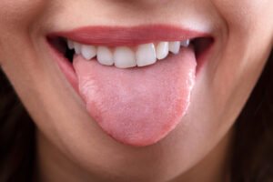 a woman sticking out her healthy tongue after seeing a Shingle Springs Dentist